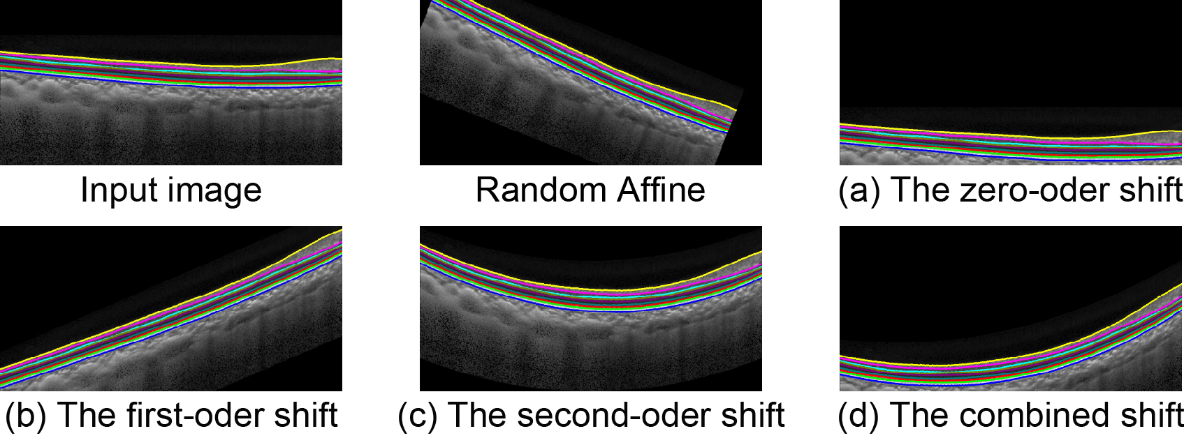 Examples of FDDA