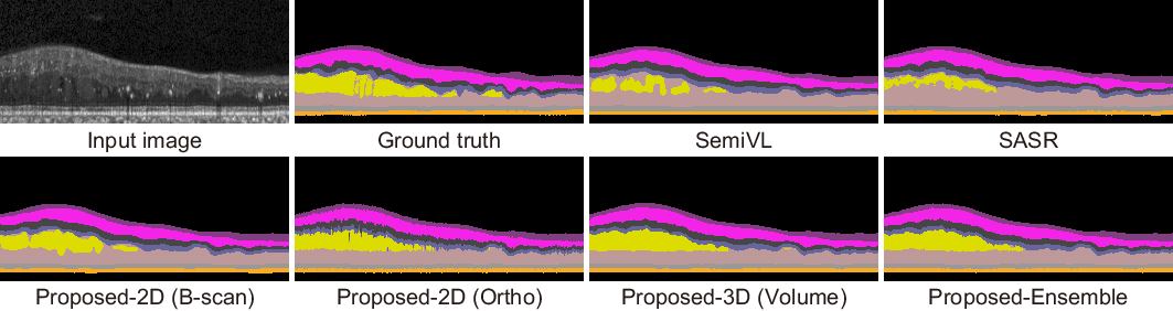 Qualitative segmentation comparison on the Duke DME dataset